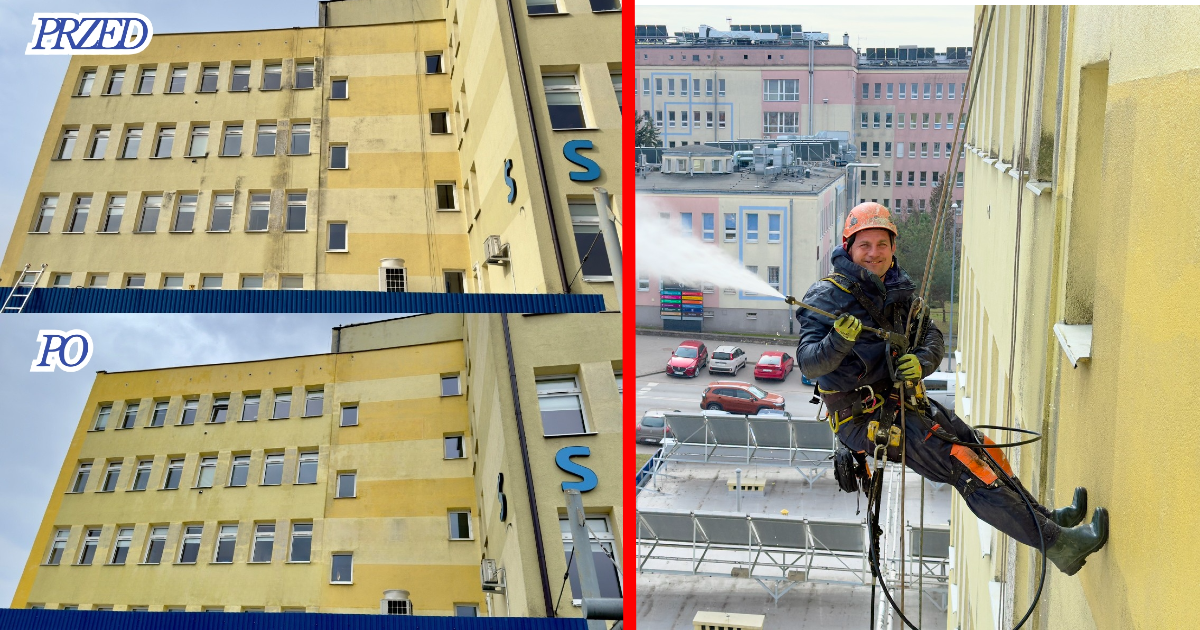 Na terenie Radomskiego Szpitala Specjalistycznego przeprowadzono prace związane  z czyszczeniem elewacji budynku Poradni Specjalistycznych przy ul. Lekarskiej. Zadanie zostało zrealizowane przez firmę Alpin Group, która odpowiedziała na apel szpitala i wykonała usługę nieodpłatnie. Działania te stanowią element bieżącego utrzymania infrastruktury oraz dbałości o estetykę i funkcjonalność obiektów placówki. 